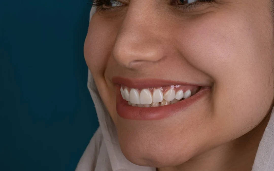 5 Foods to Avoid with Braces (And What to Eat Instead)